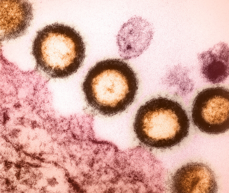 hiv-1_virus_-52372341644